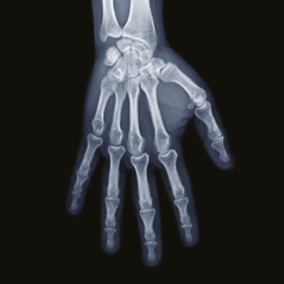 X-Ray Image
