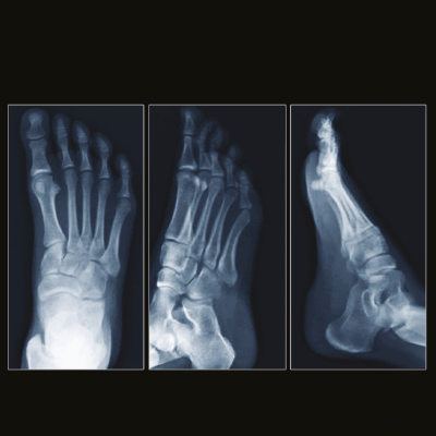 X-Ray Image