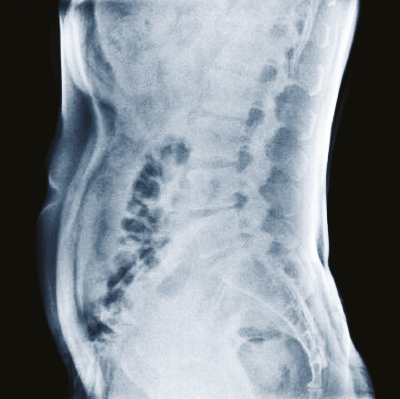 X-Ray Image