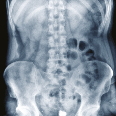 X-Ray Image